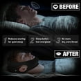 thumbnail image 5 of 1-Pack Snoring Stopper Chin Strap for Sleeping, Jaw Support for Mouth Breathing, Anti Snore Device to Keep Mouth Closed for Men and Women, 5 of 6