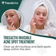 thumbnail image 2 of Crema para el tratamiento del acné TreeActiv Invisible Salicylic Acid 15 ml, 2 of 6