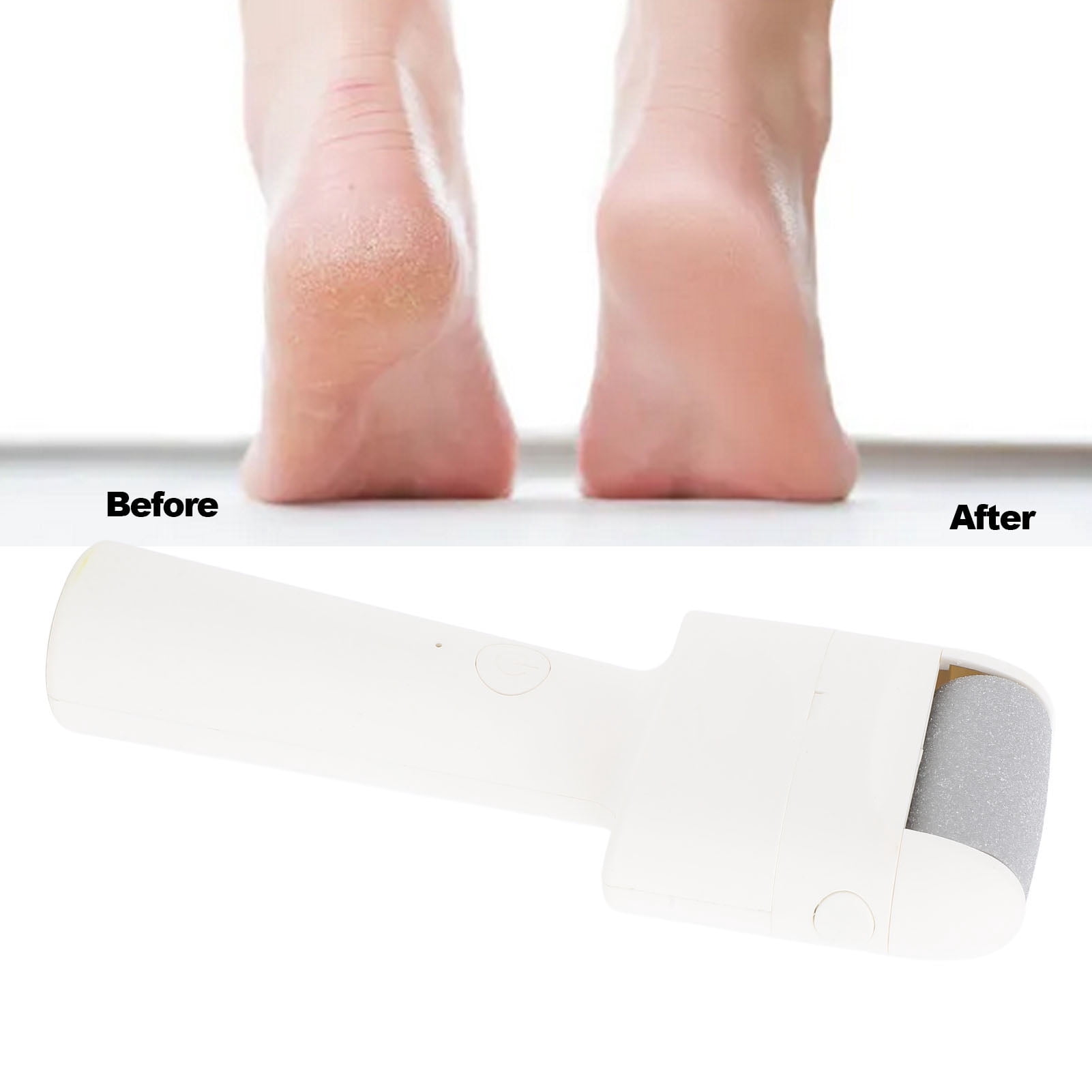 Nieyigj Electric Foot Callus Remover Portable Electric Foot File for Dead Skin and Calluses White, Professional 2-Speed Rechargeable Foot Scrubber (9.45 inches / 24 cm)