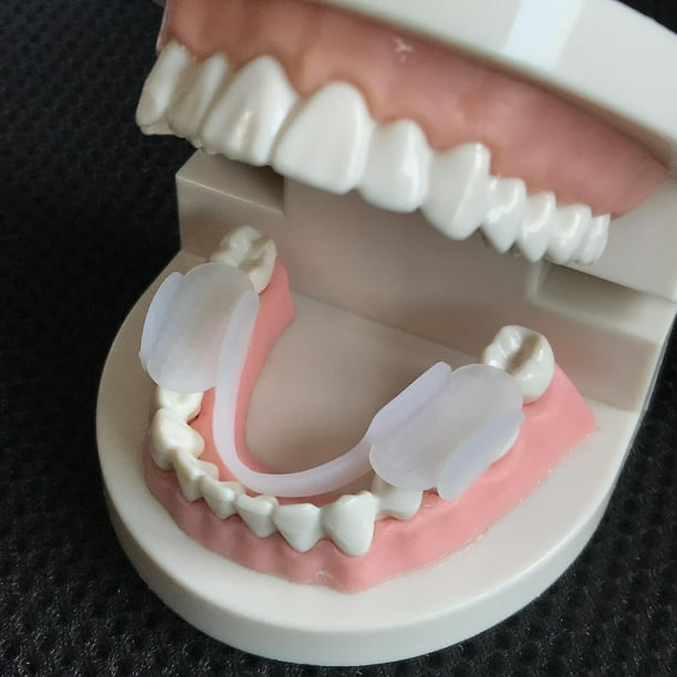 Protector bucal para bruxismo, protector bucal para dormir, férula para apretar, aparatos dentales, entrenador de alineación, ayuda para dormir, herramientas protectoras de dientes