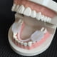 thumbnail image 1 of Protector bucal para bruxismo, protector bucal para dormir, férula para apretar, aparatos dentales, entrenador de alineación, ayuda para dormir, herramientas protectoras de dientes, 1 of 4