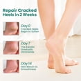 thumbnail image 2 of Welnove 2 Pairs Moisturizing Heel Socks - Aloe Vera Gel for Dry, Cracked Heels Repair Treatment - Cotton Foot Care Socks For Women, Men - Blue, Extra Large, 2 of 7