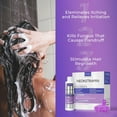 thumbnail image 5 of Anti -Fungal Shampoo - Anti-Dandruff Medicated Shampoo Dry Scalp Treatment - Soothes Itchy, Flaky, and Irritated Scalp - Paraben-Free, Sulphate-Free Massager Brush Bundle Set, 5 of 7