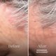 thumbnail image 4 of Champú para cuero cabelludo LolaVie Exfoliate & Detox 2 en 1, 180 ml, con carbón, 4 of 5