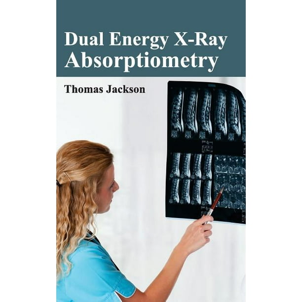 Dual Energy XRay Absorptiometry (Hardcover)
