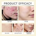 thumbnail image 4 of 40-120pcs Acid & Turmeric Kojic Cleansing Pads - Gentle Exfoliating Face Pads for Dark Spots & Dead Skin Removal, 4 of 5