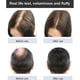 thumbnail image 5 of Ginger Plant Extract Anti-hair Loss Hair Shampoo, 2024 New Ginger Plant Extract Anti-hair Loss Hair Shampoo, Ginger Shampoo For Hair Growth, 5 of 5