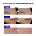 thumbnail image 3 of Blemish Spot Patch Mediheal Derma Clear Madecassoside 132 unidades, 3 of 8
