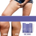 thumbnail image 3 of 10 Pcs Thigh Firming Stickers Clear Adhesive Strips Instantly Cellulite and Sagging Skin, 3 of 8