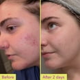 thumbnail image 3 of Good Molecules 10% Azelaic Acid Treatment - Soothing Formula for Facial Redness & Uneven Tone, Brightens Dark Spots & Refines Texture, Skincare for Face, 1 fl oz, 3 of 7