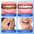 thumbnail image 2 of Pasta de dientes con hidroxiapatita microcristalina, 50 g, eliminador de manchas, 2 of 9