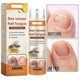 thumbnail image 2 of 3X Bee Venom Nail Repair Serum, Nail Care Solution, Natural Bee Venom Nail Care Spray, Ingrown Toenail Care Spray, 2 of 5