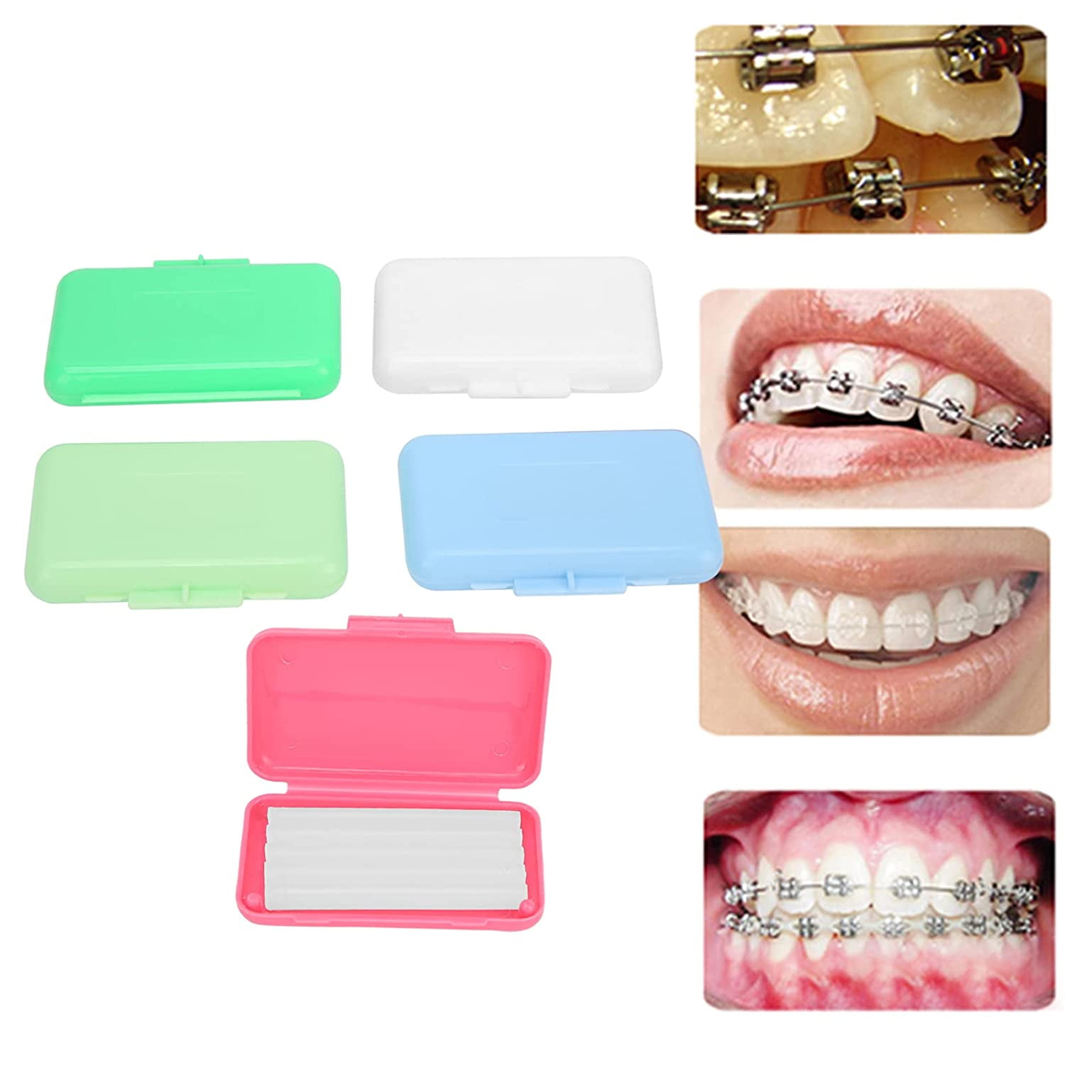 Dental Oral Care Orthodontics Wax with Fruit Smell for Brace Wearers