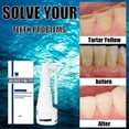 thumbnail image 2 of Aerosol disolvente dental removedor de sarro 2 piezas yuxing, 2 of 5