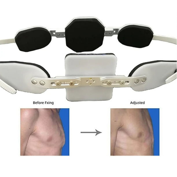 Adjustable Pectus Carinatum Orthosis Brace Pigeon Chest Orthosis