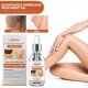 thumbnail image 2 of Pack of 2 Acanthosis Nigricans Treatment Oil 50ml, 2 of 4