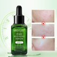 thumbnail image 3 of 17ml esencia de árbol de té, reafirmante poros contracción hidratante anti-acné esencia aceite control Yanshi Poros contracción serum, 3 of 6