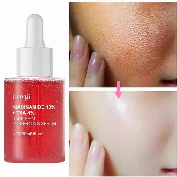 Hydrating Stabilizer, Cools, Calms, Evens, Moisturizes and Balances Oily Skin Types, Restores Discoloration and Moisturizes