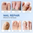thumbnail image 4 of Parches para uñas FANSHI, 21 piezas, reparación nocturna con hidrogel, 4 of 7