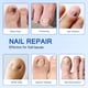 thumbnail image 4 of Parches para uñas FANSHI, 21 piezas, reparación nocturna con hidrogel, 4 of 7