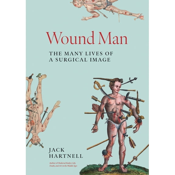 Wound Man: The Many Lives of a Surgical Image, (Hardcover)