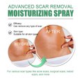 thumbnail image 2 of Spray para eliminar cicatrices, mejora la piel suave, Gel reparador de manchas de acné, piel reafirmante suave, 2 of 4