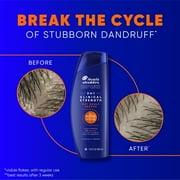 Head and Shoulders Clinical Strength Dry Scalp Rescue 2in1, for Stubborn Dandruff, 13.5 fl oz