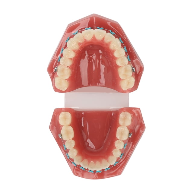 Modelo de dientes con soporte de metal BuyWeekMX 28 piezas Modelo de ortodoncia didáctico