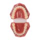 thumbnail image 1 of Modelo de ortodoncia ANGGREK Diente de ortodoncia de maloclusión 28 piezas, 1 of 8