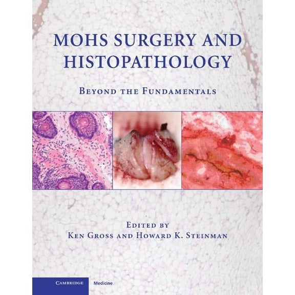 Mohs Surgery and Histopathology: Beyond the Fundamentals, (Hardcover)