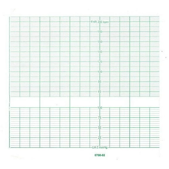 BIONET CARDIOCARE ECG Paper 152MM X 25M (5)