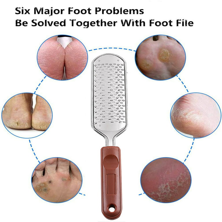 YEEPSYS Foot Scrubber, Pedicure Feet File, Dead Skin Scraper, Callus  Remover for Dry and Wet Feet