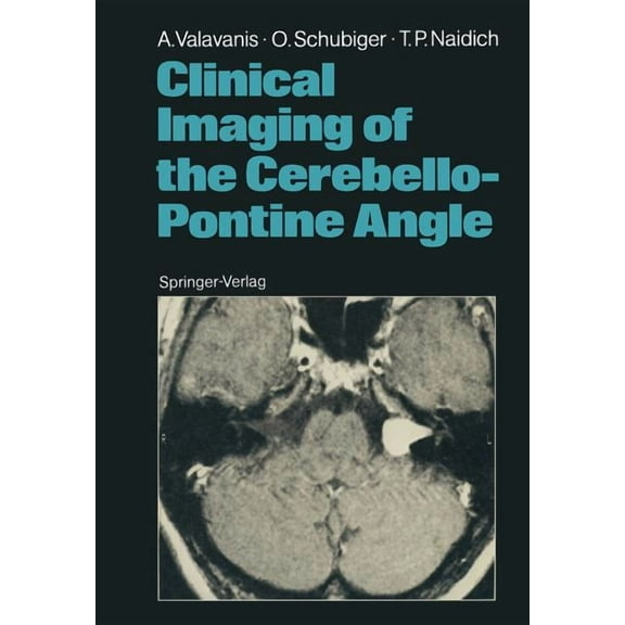Clinical Imaging of the Cerebello-Pontine Angle, (Paperback)