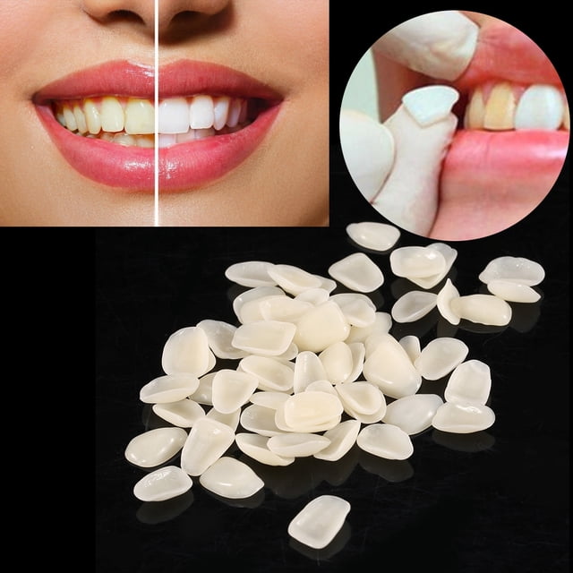 Corona dental, 70PCS/Bolsa Carillas dentales Resina Corona dental temporal Corona de dientes Eficiencia maximizada