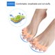 thumbnail image 4 of Ygjytge 2 Separadores De Dedos Hallux Valgus Corrector Hammer Straightener (Beige Adulto) Ygjytge Para estrenar, 4 of 9