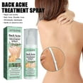 thumbnail image 2 of Back Body Acne Treatment Spray with Salicylic Acid, 2 of 5