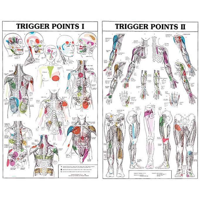 Trigger Points I And Ii Chart Laminated