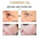 thumbnail image 5 of Suero corrector de manchas oscuras de cúrcuma, suero facial reparador de cúrcuma para tratamiento facial de Melasma, 2 uds., 5 of 5