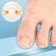 thumbnail image 4 of Herramienta para el Cuidado de los Pies JShteea Corrección de Uñas Encarnadas 2 Uds, 4 of 9