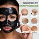 thumbnail image 3 of Mascarilla eliminadora de puntos negros ulluxe Black Charcoal con extractor, 3 of 9