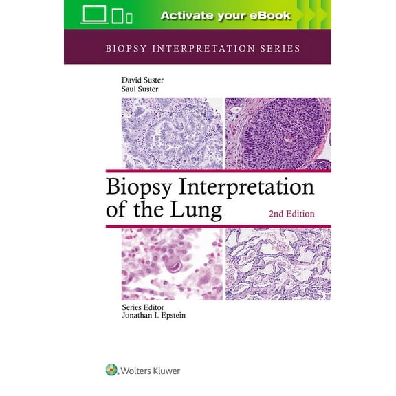 Biopsy Interpretation: Biopsy Interpretation of the Lung (Hardcover)