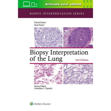 UPC: 9781975136581 | Biopsy Interpretation: Biopsy Interpretation of the Lung (Hardcover)