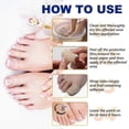 thumbnail image 3 of Fungal Nail Patches,Multi-Purpose Toenail Repair Treatment Pads for Restores Damaged Nails and Appearance of Discolored, 3 of 5