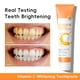 thumbnail image 2 of Xihbxyly Pasta Dental con Vitamina C, Fórmula Quitamanchas, Mezcla de Menta para Un Aliento Fresco, Protección para Las Encías, Higiene Bucal Diaria, Ideal para Encías Sensibles, Tamaño Práctico de 8, 2 of 7