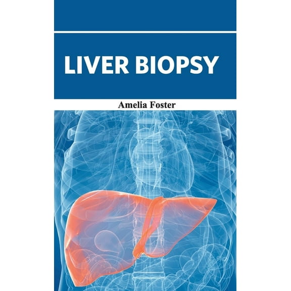 Liver Biopsy, (Hardcover)
