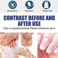 thumbnail image 3 of Aceite para el cuidado de las uñas,CAIXIN solución de tratamiento de uñas 30ml detiene las infecciones por hongos en las uñas para hombres y mujeres, 3 of 6