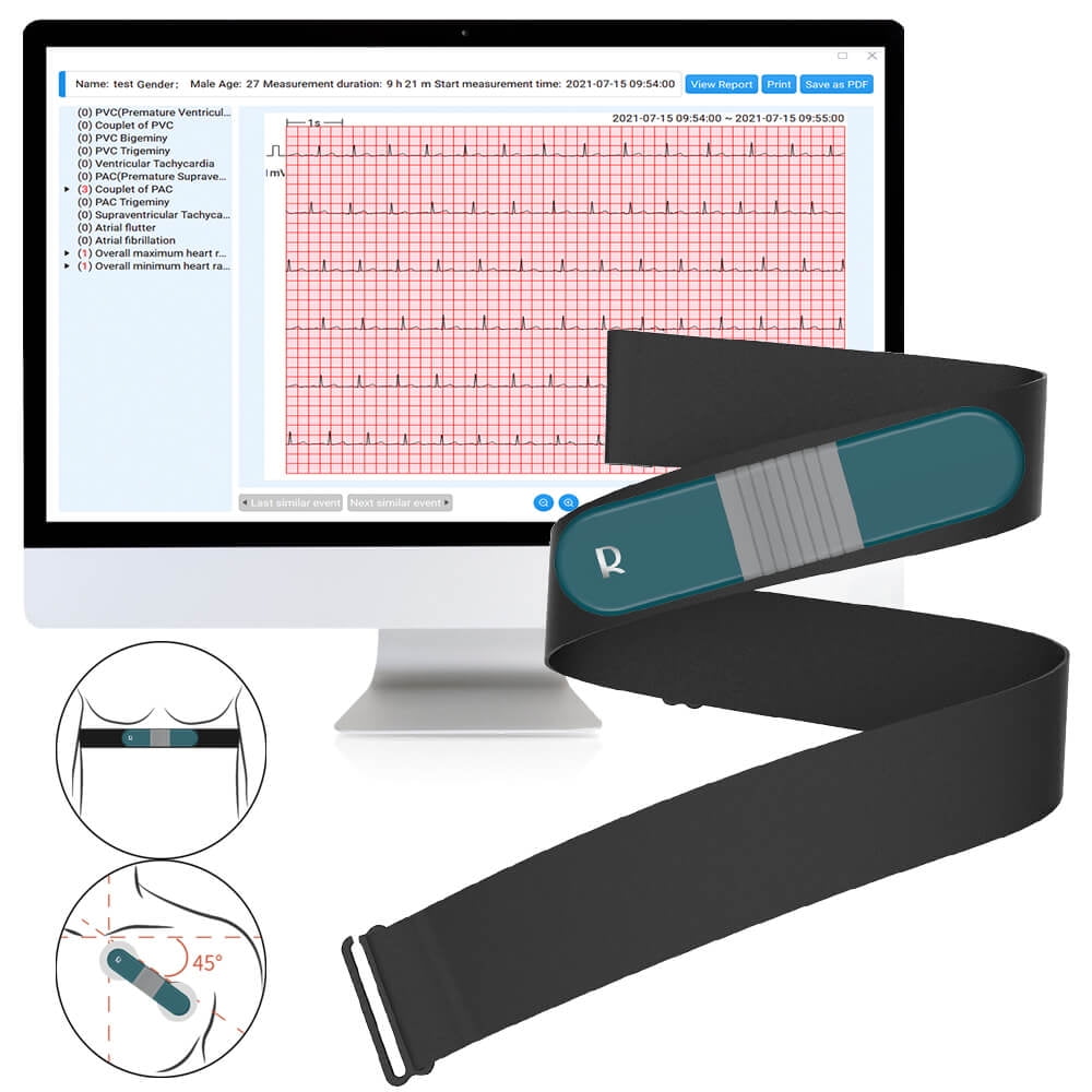 Checkme Portable EKG Monitor, 24-Hour Heart Rate Recorder, AI