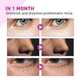 thumbnail image 3 of Éliminateur de Milium, Traitement des Taches de Milium Dissolution Réduction des Milium, Sérum pour les Yeux 30 ml Raffermissement des Rides Réduction des Cernes, 3 of 5