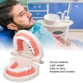 thumbnail image 4 of Modelo De Dientes Dentales, Modelo De Diente De Caries De Resina Para Clínica Para Estudiantes, 4 of 7
