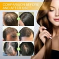 thumbnail image 7 of Ibealee-Biotin-Hair-Growth-Spray-Serum-Thickening-Herbal-Anti-Loss-Serum-Women-Men-Loss-1-PCS, 7 of 7